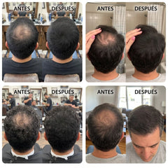 Hairline™- Cubre Calvas y Canas Instantáneo