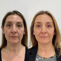 Valeria, 38